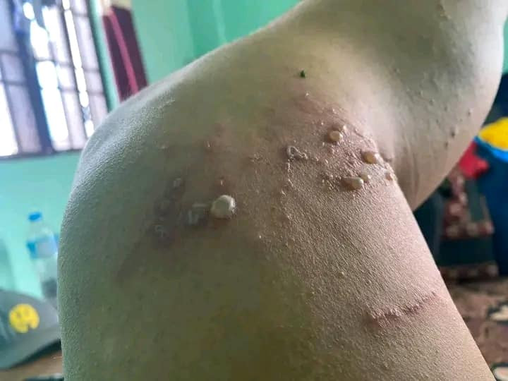 धनगढीमा ‘नाइरोबी फ्लाई’ कीराको समस्या बढ्दै